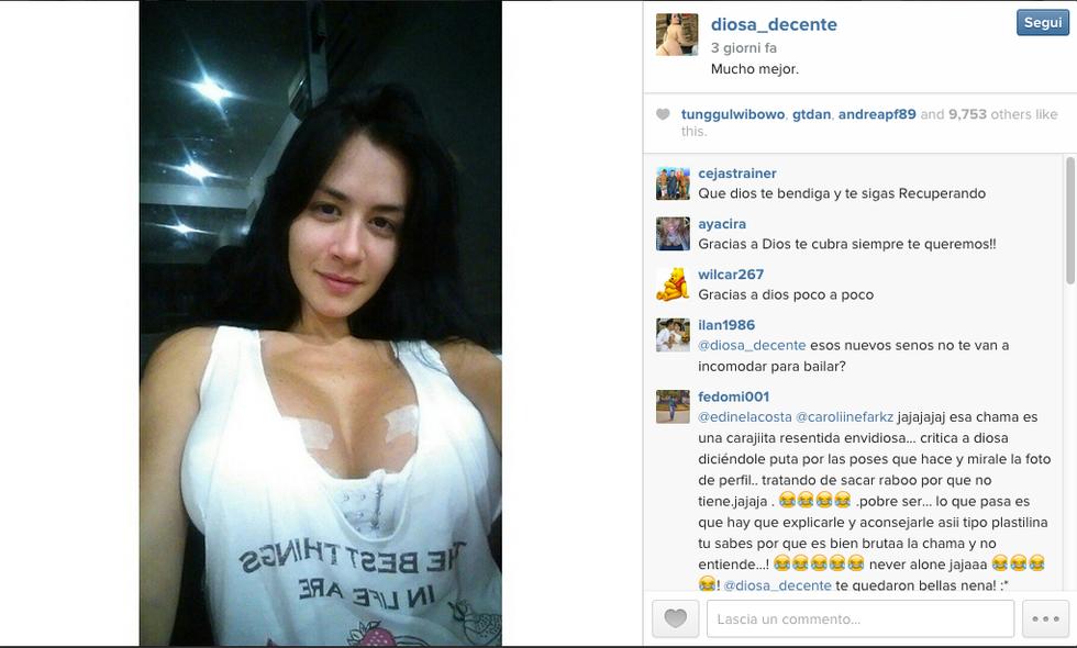 Alla Kim Kardashian venezuelana esplode il seno durante uno spettacolo