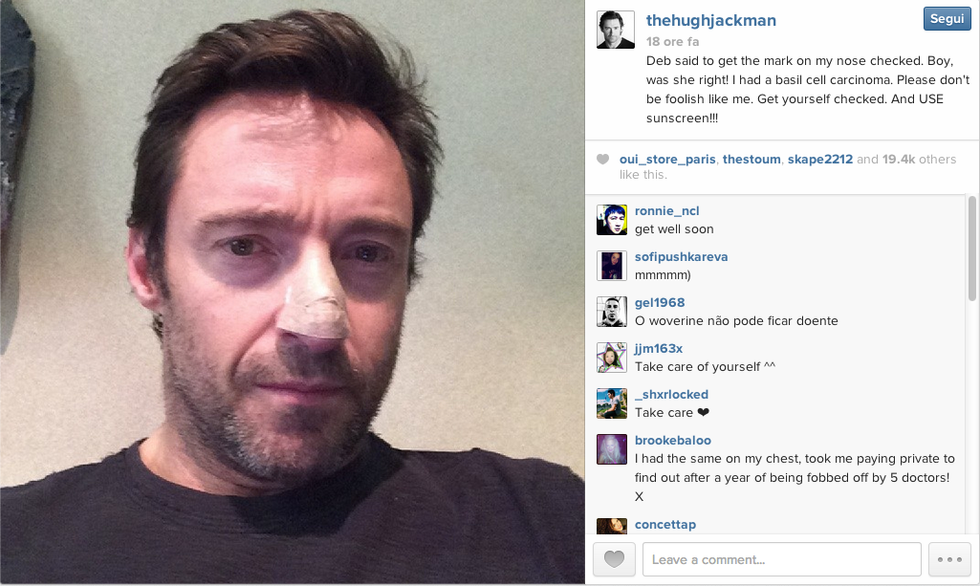 Hugh Jackman: "Ho un tumore alla pelle"