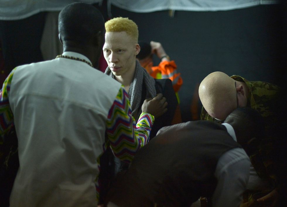 In Kenya la prima sfilata per modelli albini