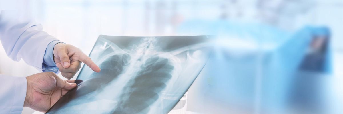 ​Radiografia polmoni tumori diagnostica