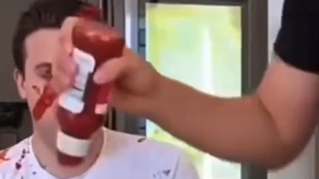 Ragazzo alle prese con patatine fritto viene ricoperto di Ketchup | video