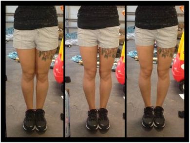 Thigh-Gap, la nuova ossessione delle adolescenti