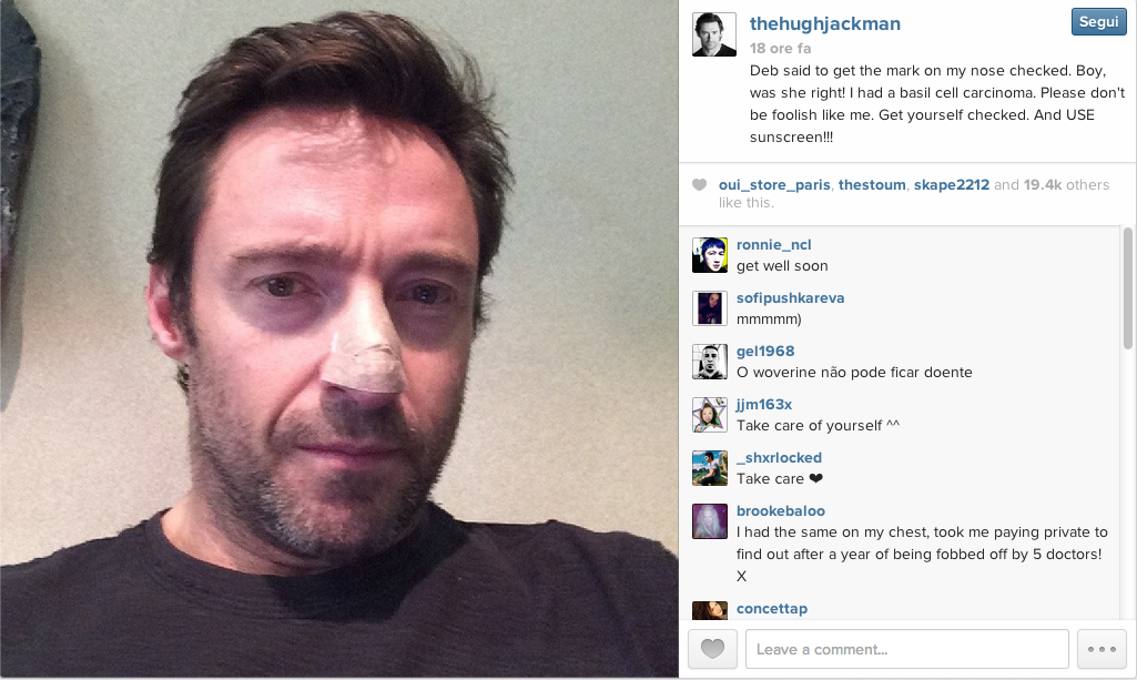 Hugh Jackman: “Ho un tumore alla pelle” Hugh Jackman: “Ho un tumore alla pelle”
