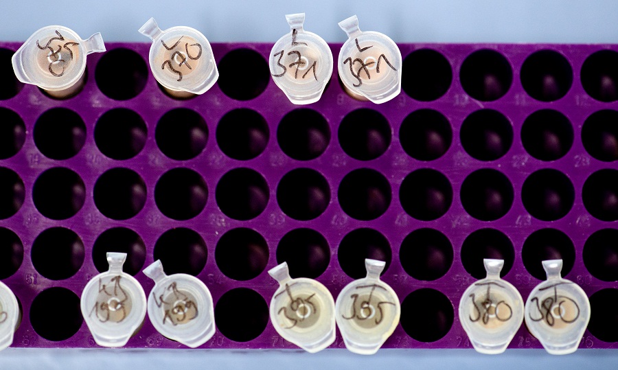 Uzbekistan, test del Dna per scovare i futuri olimpionici Uzbekistan, test del Dna per scovare i futuri olimpionici