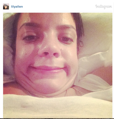 Lily Allen e il selfie più brutto della storia