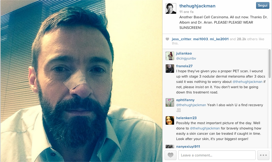 Hugh Jackman, secondo intervento per il cancro alla pelle Hugh Jackman, secondo intervento per il cancro alla pelle