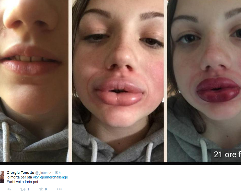 L’ultima follia delle teenager: il #kyliejennerchallenge