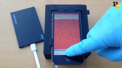 Così lo smartphone diventa microscopio