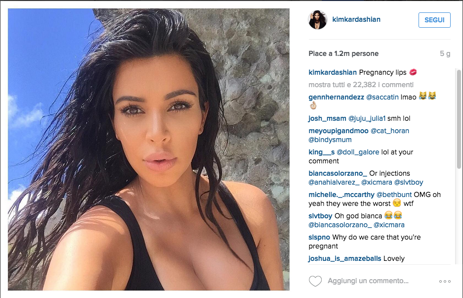 Kim Kardashian è a rischio isterectomia Kim Kardashian è a rischio isterectomia