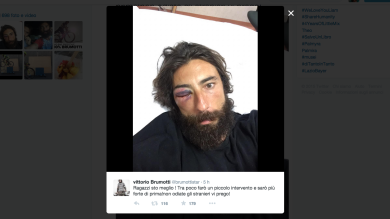 Vittorio Brumotti picchiato durante una lite stradale