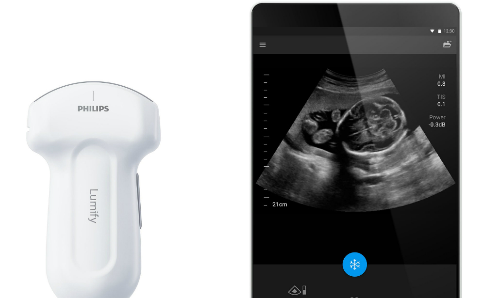 Così la tecnologia di Philips migliora la nostra salute Così la tecnologia di Philips migliora la nostra salute