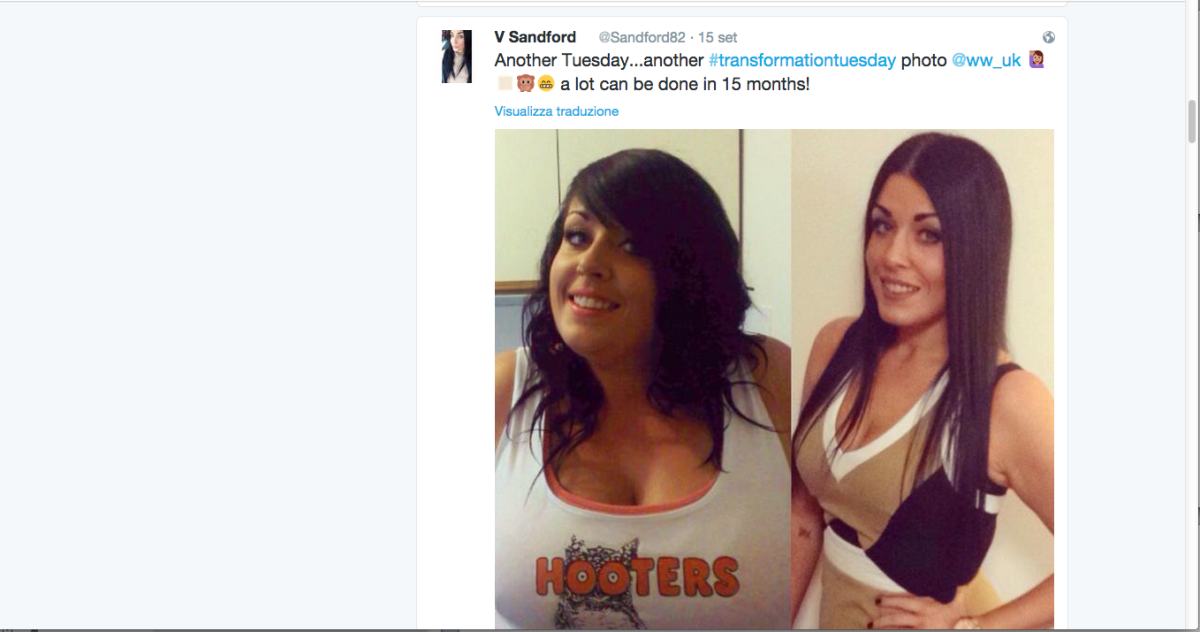 Galleria foto 'Perde 50 chili per assomigliare a Kim Kardashian' - foto 2