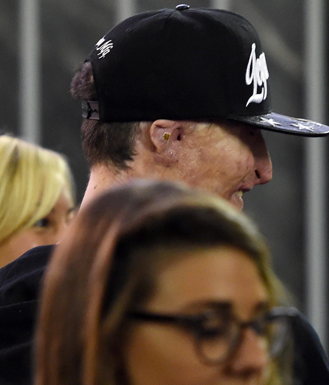 Coppia dell’acido, il ragazzo sfigurato guarda negli occhi Alex Coppia dell’acido, il ragazzo sfigurato guarda negli occhi Alex