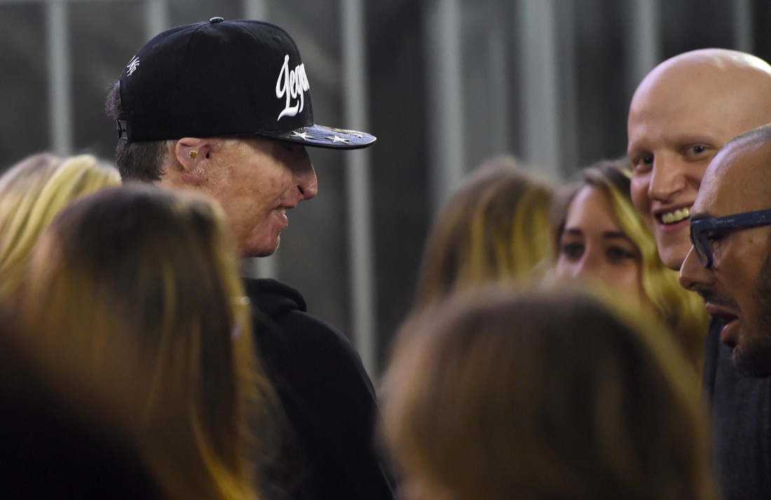 Coppia dell’acido, il ragazzo sfigurato guarda negli occhi Alex Coppia dell’acido, il ragazzo sfigurato guarda negli occhi Alex