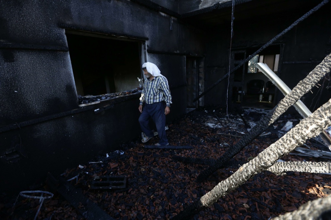 Muore anche la mamma del bimbo palestinese ucciso nel rogo di luglio Muore anche la mamma del bimbo palestinese ucciso nel rogo di luglio