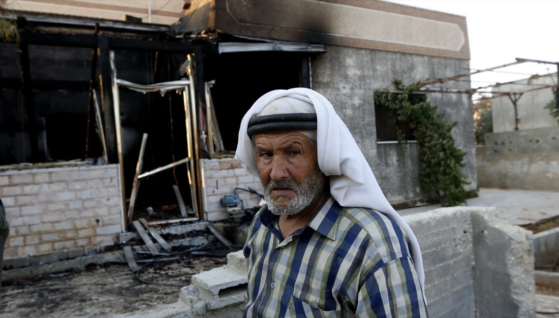 Muore anche la mamma del bimbo palestinese ucciso nel rogo di luglio Muore anche la mamma del bimbo palestinese ucciso nel rogo di luglio