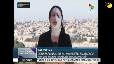 Libano, torna in tv la giornalista colpita in faccia dalla granata