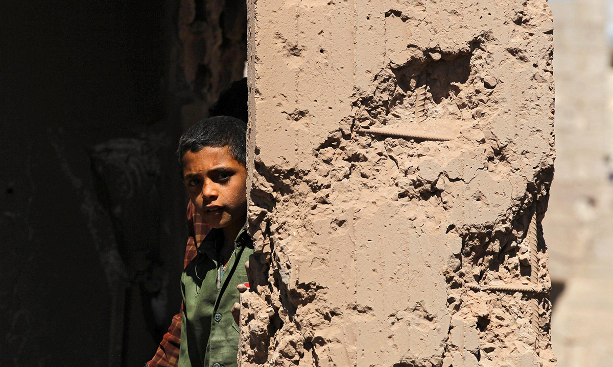 Yemen, foto della guerra dimenticata