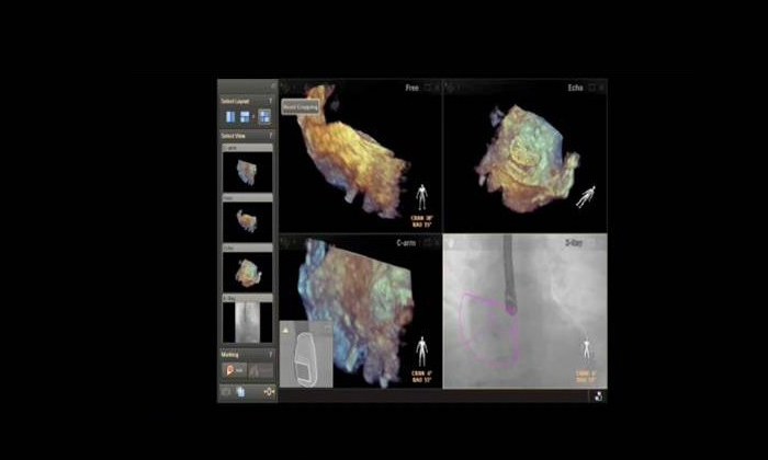 Da Philips: 10 cose che cambieranno il nostro modo di curarci