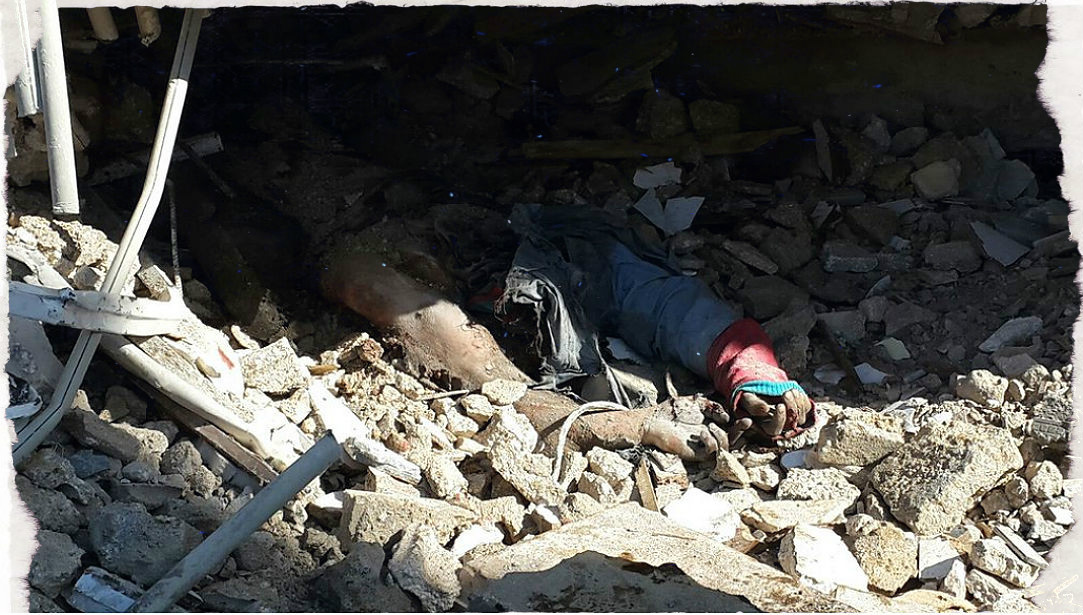 Siria, bombe su scuole e ospedali: inferno per i civili, altro che tregua – Foto, video