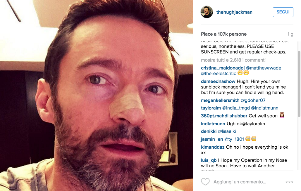 Hugh Jackman, quinto intervento per un tumore al naso