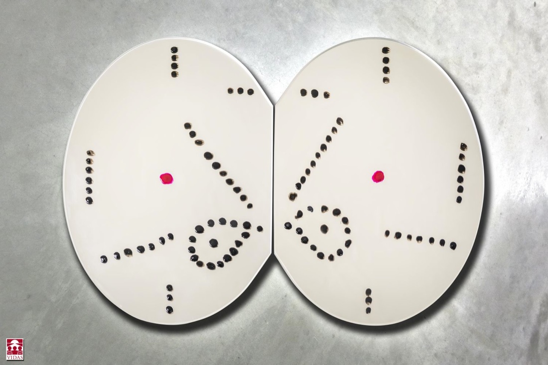 Specchio riflesso: un’asta benefica a favore di Vidas