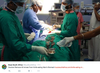 India, dolori all’addome: gli trovano 40 coltelli nello stomaco