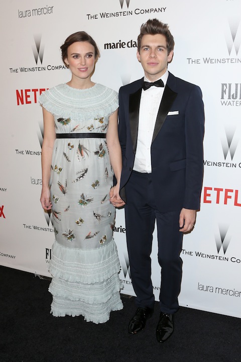 Keira Knightley: “Ho perso i capelli e devo usare le parrucche” Keira Knightley: “Ho perso i capelli e devo usare le parrucche”