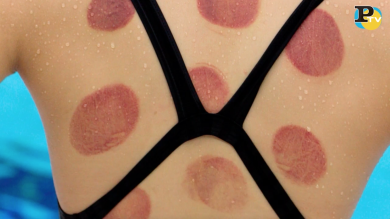 Coppettazione: ecco spiegati i cerchi rossi sugli atleti di Rio 2016