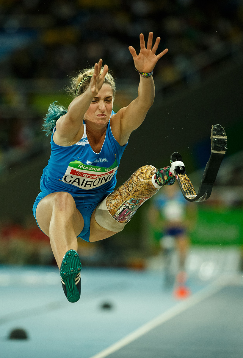 Rio 2016: le Paralimpiadi nelle foto più belle Rio 2016: le Paralimpiadi nelle foto più belle