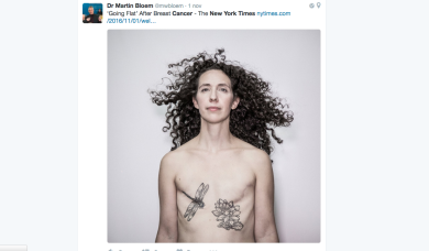 Senza protesi dopo il cancro al seno: la scelta delle donne di “Go flat”