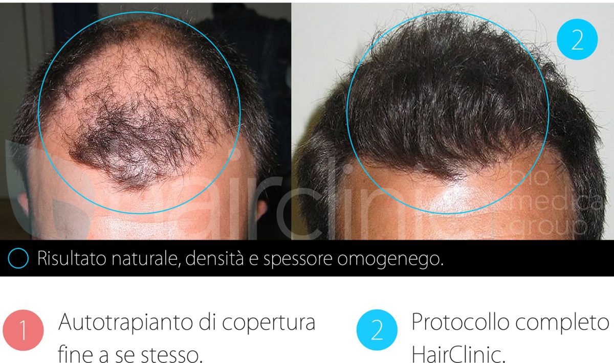 Le Pen: la Francia contro l’Europa, l’Islam, il liberismo