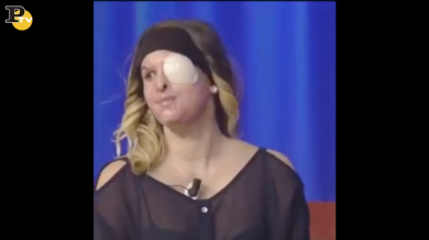 Jessica Notaro mostra il volto sfigurato dall’acido da Maurizio Costanzo