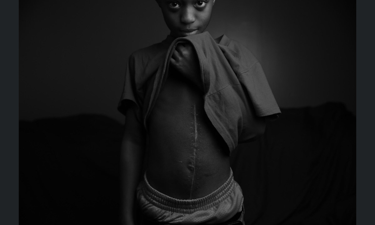 Pulitzer per la fotografia 2017: i reporter premiati