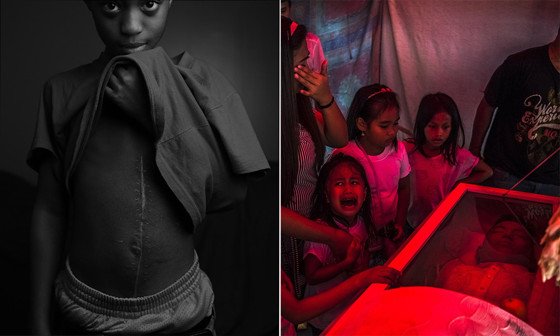 Pulitzer per la fotografia 2017: i reporter premiati