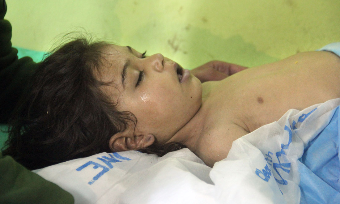 Siria, attacco con i gas: l’impotenza dell’Onu e l’ira di Trump