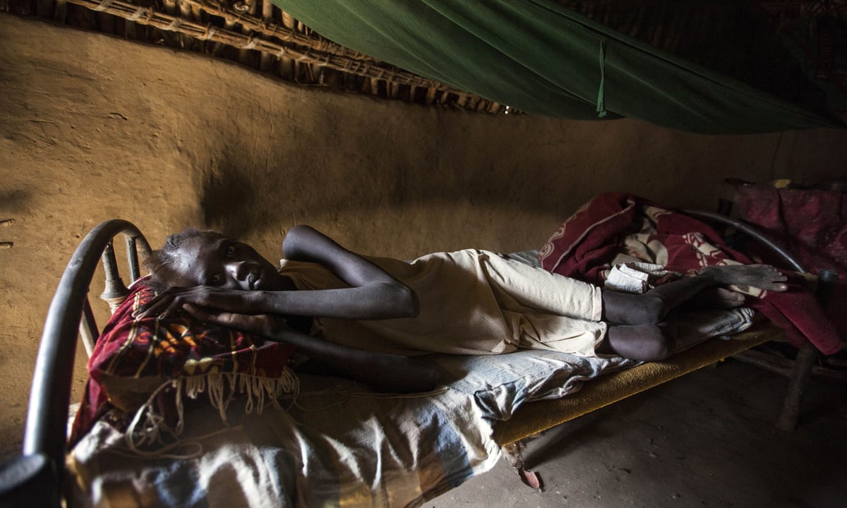 Fame nel mondo: 108 milioni di malnutriti nel 2016