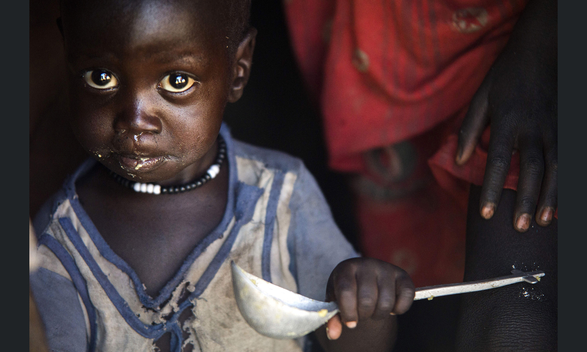 Fame nel mondo: 108 milioni di malnutriti nel 2016