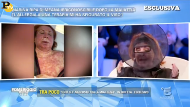 Marina Ripa di Meana a Pomeriggio 5 mostra il viso sfigurato dalla malattia