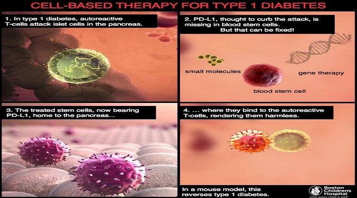 Diabete, nuova terapia con le staminali potrebbe eliminare la malattia Diabete, nuova terapia con le staminali potrebbe eliminare la malattia