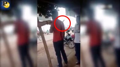 Uomo con un coltello nella schiena esce in strada come nulla fosse | video