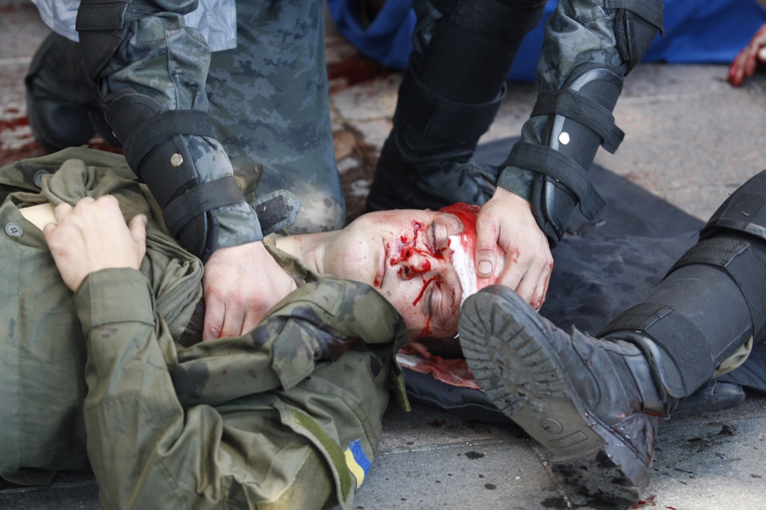Ucraina: foto (cronaca) dalla guerra Ucraina: foto (cronaca) dalla guerra