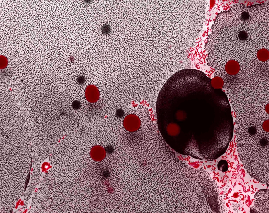 The Milky Way: una mostra solidale