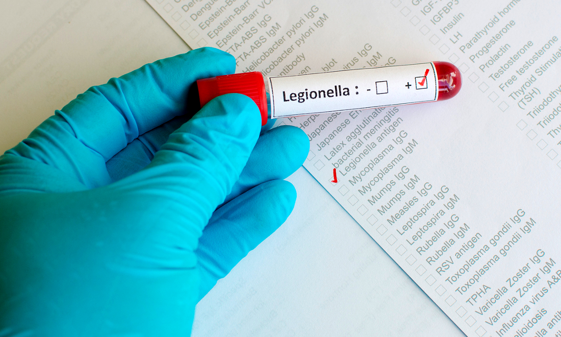 Allarme Legionella: 5 cose da sapere Allarme Legionella: 5 cose da sapere