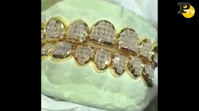 Guardate come si atteggia con al nuova dentiera di diamanti | video