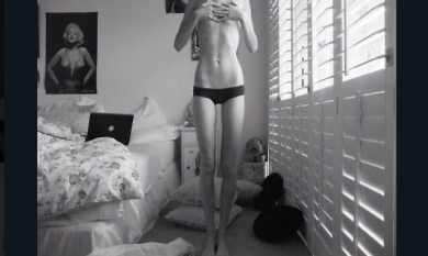 Anoressia ai tempi di instagram