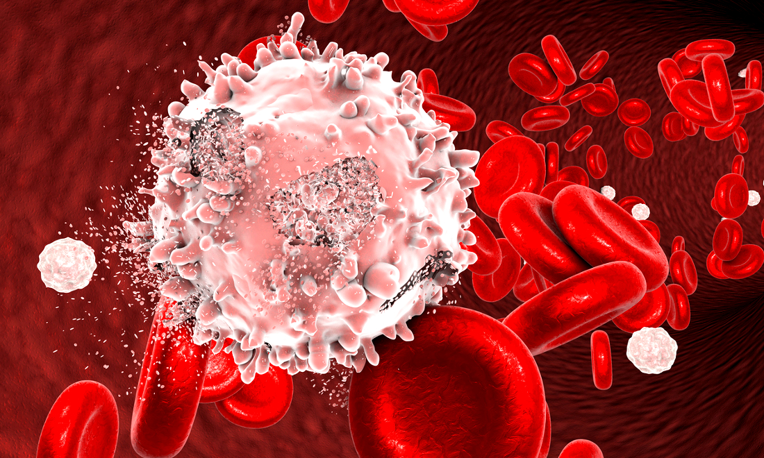 Car-T, come funziona e dove si trova la nuova cura contro la Leucemia Car-T, come funziona e dove si trova la nuova cura contro la Leucemia