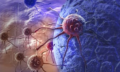 Il tumore di Jason ed il potere del suo sistema immunitario