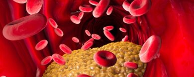 Colesterolo: scoperto a Torino un anticorpo che lo riduce drasticamente