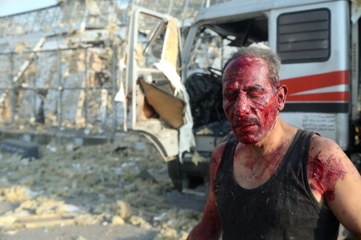 Beirut, le foto dopo l’esplosione che ha fatto più di 100 morti